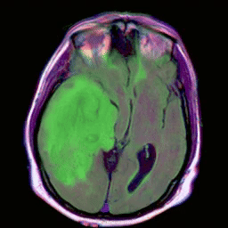 image-segmentation-before